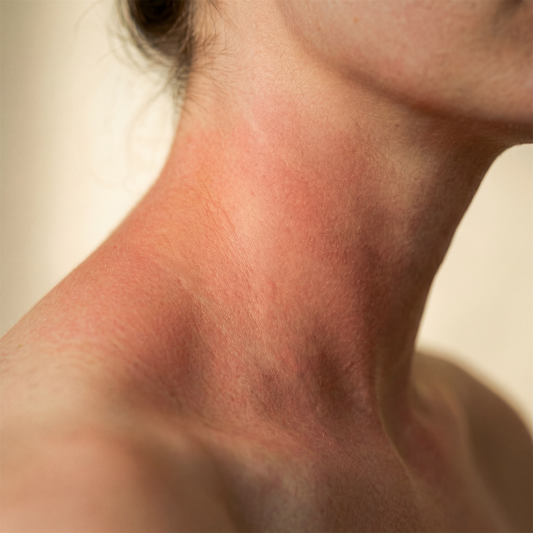 Editorial macro close-up of adult skin during an active niacin flush — a warm rosy-coral blush visible along the side of the neck at the base of the jaw, softening into cooler cream-toned healthy skin at the shoulder and collarbone below, warm directional light from the upper left.
